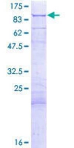 Novus Biologicals Recombinant Human Pyruvate Dehydrogenase E2 GST (N-Term) Protein 2 &mu;g | Buy Online | Novus Biologicals&trade; | Fisher Scientific