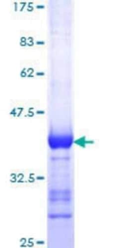 Novus Biologicals Recombinant Human DLG1 GST (N-Term) Protein 25 &mu;g | Buy Online | Novus Biologicals&trade; | Fisher Scientific