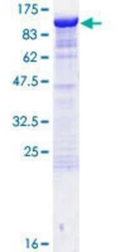 Novus Biologicals Recombinant Human SAP102 GST (N-Term) Protein 25 &mu;g | Buy Online | Novus Biologicals&trade; | Fisher Scientific