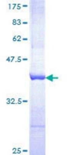 Novus Biologicals Recombinant Human PSD-95 GST (N-Term) Protein 25 &mu;g | Buy Online | Novus Biologicals&trade; | Fisher Scientific