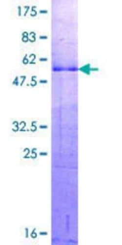 Novus Biologicals Recombinant Human Dlx1 GST (N-Term) Protein 2 &mu;g | Buy Online | Novus Biologicals&trade; | Fisher Scientific