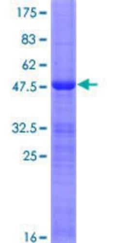 Novus Biologicals Recombinant Human Dlx6 GST (N-Term) Protein 25 &mu;g | Buy Online | Novus Biologicals&trade; | Fisher Scientific