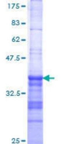 Novus Biologicals Recombinant Human Dlx6 GST (N-Term) Protein 10 &mu;g | Buy Online | Novus Biologicals&trade; | Fisher Scientific