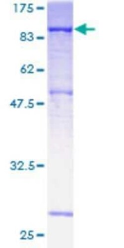 Novus Biologicals Recombinant Human DMPK GST (N-Term) Protein 10 &mu;g | Buy Online | Novus Biologicals&trade; | Fisher Scientific