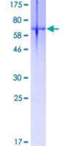 Novus Biologicals Recombinant Human DMRT1 GST (N-Term) Protein 10 &mu;g | Buy Online | Novus Biologicals&trade; | Fisher Scientific