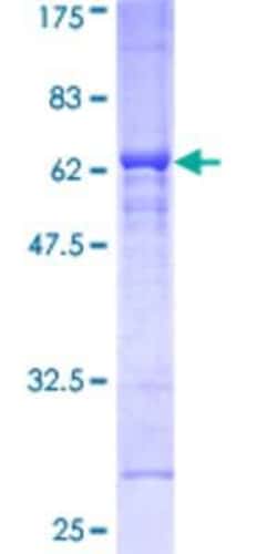 Novus Biologicals Recombinant Human dystrophia myotonica containing WD repeat motif GST (N-Term) Protein 25 &mu;g | Buy Online | Novus Biologicals&trade; | Fisher Scientific