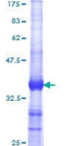 Novus Biologicals Recombinant Human dystrophia myotonica containing WD repeat motif GST (N-Term) Protein 10 &mu;g | Buy Online | Novus Biologicals&trade; | Fisher Scientific