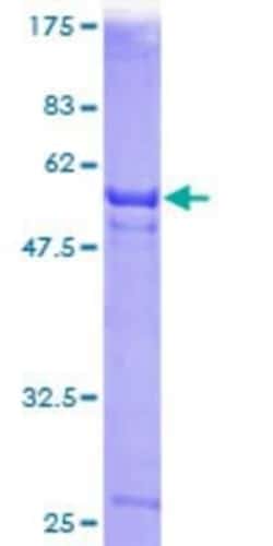 Novus Biologicals Recombinant Human Deoxyribonuclease I like 1 GST (N-Term) Protein 10 &mu;g | Buy Online | Novus Biologicals&trade; | Fisher Scientific