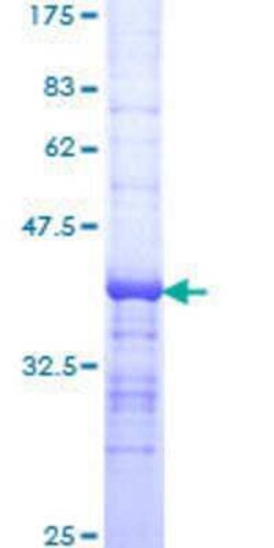 Novus Biologicals Recombinant Human DNase II GST (N-Term) Protein 25 &mu;g | Buy Online | Novus Biologicals&trade; | Fisher Scientific