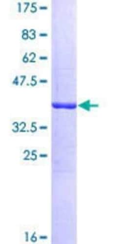 Novus Biologicals Recombinant Human DYNC1H1 GST (N-Term) Protein 10 &mu;g | Buy Online | Novus Biologicals&trade; | Fisher Scientific