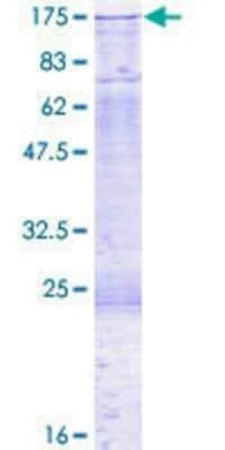 Novus Biologicals Recombinant Human DNMT3A GST (N-Term) Protein 2 &mu;g | Buy Online | Novus Biologicals&trade; | Fisher Scientific