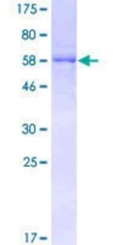 Novus Biologicals Recombinant Human DOCK2 GST (N-Term) Protein 25 &mu;g | Buy Online | Novus Biologicals&trade; | Fisher Scientific