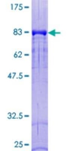 Novus Biologicals Recombinant Human DOK1 GST (N-Term) Protein 25 &mu;g | Buy Online | Novus Biologicals&trade; | Fisher Scientific