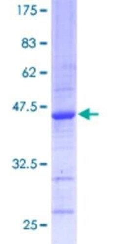 Novus Biologicals Recombinant Human DPYD GST (N-Term) Protein 10 &mu;g | Buy Online | Novus Biologicals&trade; | Fisher Scientific