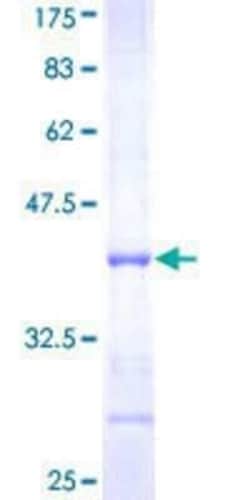 Novus Biologicals Recombinant Human DPYS GST (N-Term) Protein 10 &mu;g | Buy Online | Novus Biologicals&trade; | Fisher Scientific
