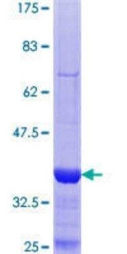 Novus Biologicals Recombinant Human CRMP2 GST (N-Term) Protein 25 &mu;g | Buy Online | Novus Biologicals&trade; | Fisher Scientific