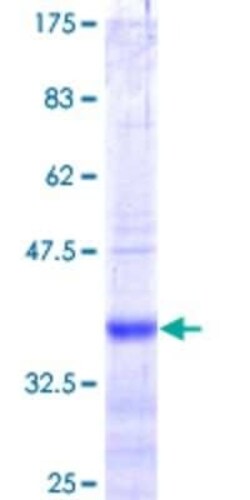 Novus Biologicals Recombinant Human SLC26A3 GST (N-Term) Protein 10 &mu;g | Buy Online | Novus Biologicals&trade; | Fisher Scientific