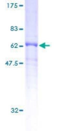 Novus Biologicals Recombinant Human DRG2 GST (N-Term) Protein 25 &mu;g | Buy Online | Novus Biologicals&trade; | Fisher Scientific