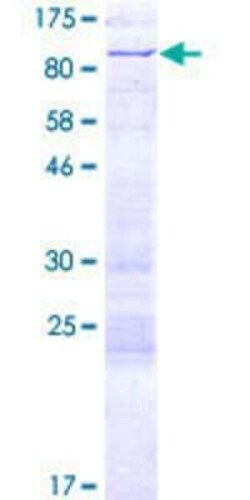 Novus Biologicals Recombinant Human DRIL1 GST (N-Term) Protein 2 &mu;g | Buy Online | Novus Biologicals&trade; | Fisher Scientific