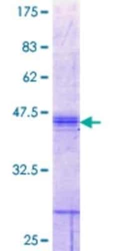 Novus Biologicals Recombinant Human SLC26A2 GST (N-Term) Protein 25 &mu;g | Buy Online | Novus Biologicals&trade; | Fisher Scientific