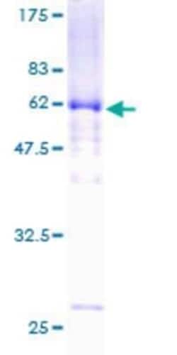 Novus Biologicals Recombinant Human Dystrobrevin alpha GST (N-Term) Protein 2 &mu;g | Buy Online | Novus Biologicals&trade; | Fisher Scientific