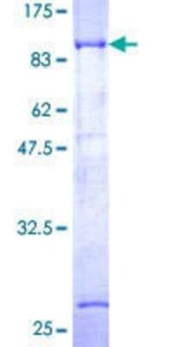 Novus Biologicals Recombinant Human Dystrobrevin beta GST (N-Term) Protein 2 &mu;g | Buy Online | Novus Biologicals&trade; | Fisher Scientific