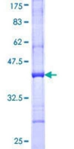Novus Biologicals Recombinant Human Dystrobrevin beta GST (N-Term) Protein 10 &mu;g | Buy Online | Novus Biologicals&trade; | Fisher Scientific