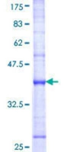 Novus Biologicals Recombinant Human DUSP8 GST (N-Term) Protein 25 &mu;g | Buy Online | Novus Biologicals&trade; | Fisher Scientific
