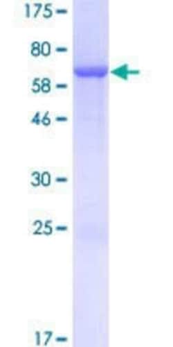 Novus Biologicals Recombinant Human DUSP9 GST (N-Term) Protein 25 &mu;g | Buy Online | Novus Biologicals&trade; | Fisher Scientific