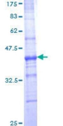 Novus Biologicals Recombinant Human DUSP9 GST (N-Term) Protein 2 &mu;g | Buy Online | Novus Biologicals&trade; | Fisher Scientific