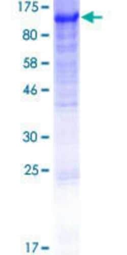 Novus Biologicals&trade;&nbsp;Recombinant Human Dishevelled-2 GST (N-Term) Protein