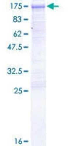Novus Biologicals Recombinant Human Dishevelled-3 GST (N-Term) Protein 25 &mu;g | Buy Online | Novus Biologicals&trade; | Fisher Scientific