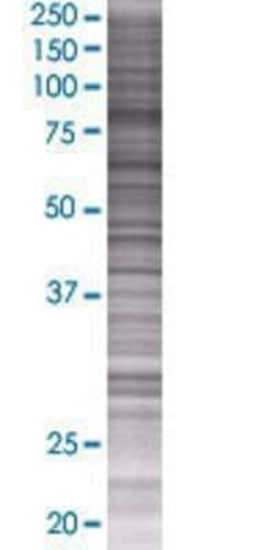 Novus Biologicals Dishevelled-3 293T Cell Transient Overexpression Lysate 0.1 mL | Buy Online | Novus Biologicals&trade; | Fisher Scientific