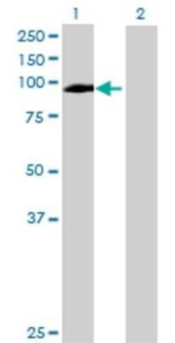 Novus Biologicals Dishevelled-3 293T Cell Transient Overexpression Lysate 0.1 mL | Buy Online | Novus Biologicals&trade; | Fisher Scientific