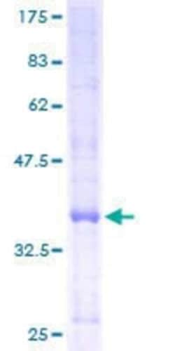 Novus Biologicals Recombinant Human E2F-2 GST (N-Term) Protein 10 &mu;g | Buy Online | Novus Biologicals&trade; | Fisher Scientific