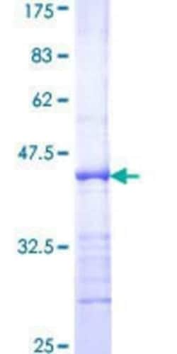 Novus Biologicals Recombinant Human E2F-2 GST (N-Term) Protein 25 &mu;g | Buy Online | Novus Biologicals&trade; | Fisher Scientific