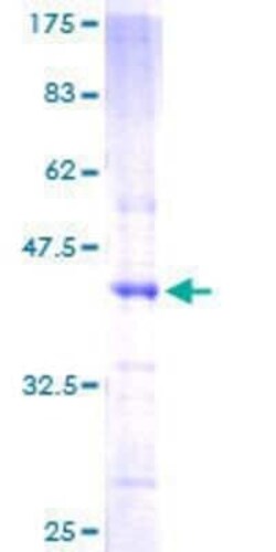 Novus Biologicals Recombinant Human E2F3 GST (N-Term) Protein 10 &mu;g | Buy Online | Novus Biologicals&trade; | Fisher Scientific