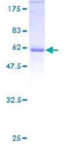 Novus Biologicals Recombinant Human E2F6 GST (N-Term) Protein 25 &mu;g | Buy Online | Novus Biologicals&trade; | Fisher Scientific