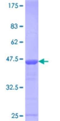 Novus Biologicals Recombinant Human E4F1 GST (N-Term) Protein 10 &mu;g | Buy Online | Novus Biologicals&trade; | Fisher Scientific