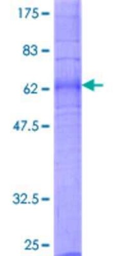 Novus Biologicals Recombinant Human LPAR1/LPA1/EDG-2 GST (N-Term) Protein 2 &mu;g | Buy Online | Novus Biologicals&trade; | Fisher Scientific