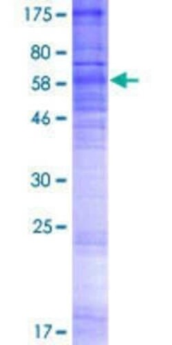 Novus Biologicals Recombinant Human S1P3/EDG-3 GST (N-Term) Protein 2 &mu;g | Buy Online | Novus Biologicals&trade; | Fisher Scientific