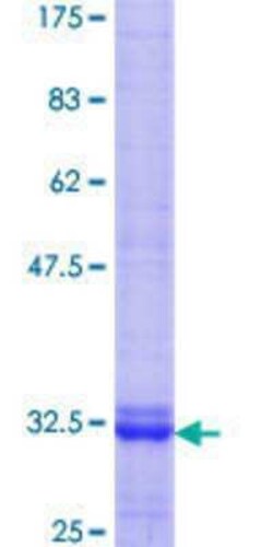 Novus Biologicals Recombinant Human S1P3/EDG-3 GST (N-Term) Protein 25 &mu;g | Buy Online | Novus Biologicals&trade; | Fisher Scientific