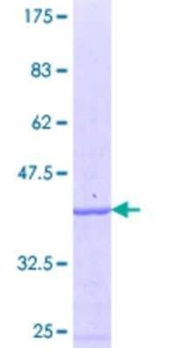Novus Biologicals Recombinant Human LGTN GST (N-Term) Protein 10 &mu;g | Buy Online | Novus Biologicals&trade; | Fisher Scientific