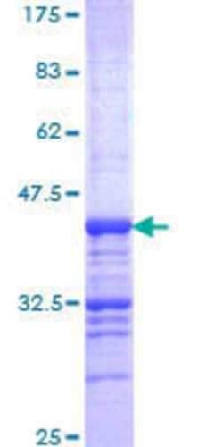 Novus Biologicals Recombinant Human CELSR2 GST (N-Term) Protein 25 &mu;g | Buy Online | Novus Biologicals&trade; | Fisher Scientific