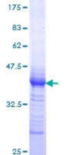 Novus Biologicals Recombinant Human EGR1 GST (N-Term) Protein 25 &mu;g | Buy Online | Novus Biologicals&trade; | Fisher Scientific