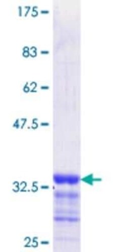 Novus Biologicals Recombinant Human EGR2 GST (N-Term) Protein 25 &mu;g | Buy Online | Novus Biologicals&trade; | Fisher Scientific