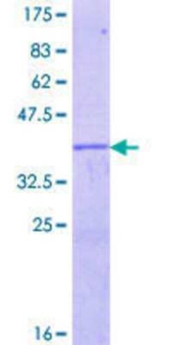 Novus Biologicals Recombinant Human EGR4 GST (N-Term) Protein 25 &mu;g | Buy Online | Novus Biologicals&trade; | Fisher Scientific