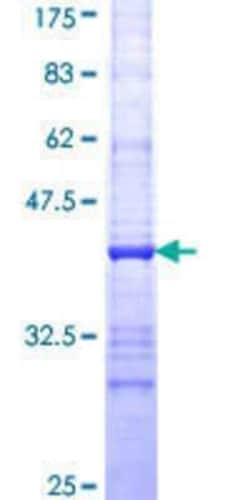 Novus Biologicals Recombinant Human EIF2G GST (N-Term) Protein 25 &mu;g | Buy Online | Novus Biologicals&trade; | Fisher Scientific