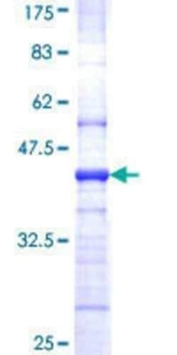 Novus Biologicals Recombinant Human eIF4A2 GST (N-Term) Protein 25 &mu;g | Buy Online | Novus Biologicals&trade; | Fisher Scientific