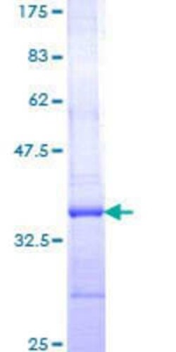 Novus Biologicals Recombinant Human DAP5 GST (N-Term) Protein 10 &mu;g | Buy Online | Novus Biologicals&trade; | Fisher Scientific